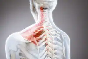 Skeletal muscular model
